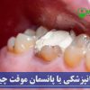 کویت دندانپزشکی یا پانسمان موقت چیست؟